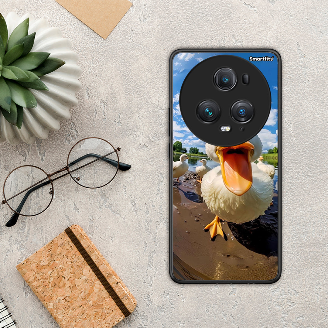 Duck Face - Honor Magic5 Pro case