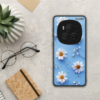 Thumbnail for Real Daisies - Honor Magic6 Pro case