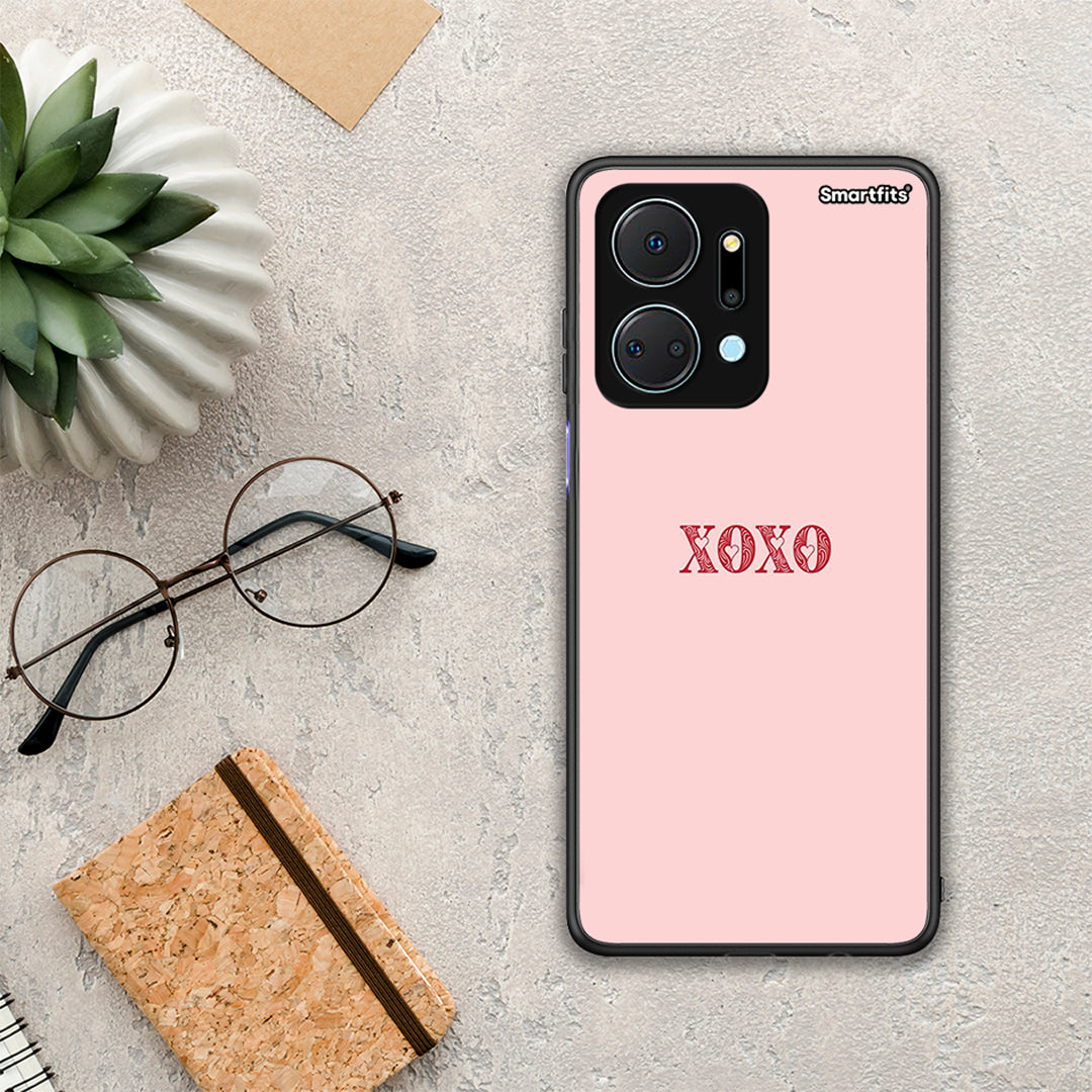 Xoxo Love - Honor X7A case