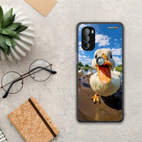 Thumbnail for Duck Face - Motorola Moto G31 case