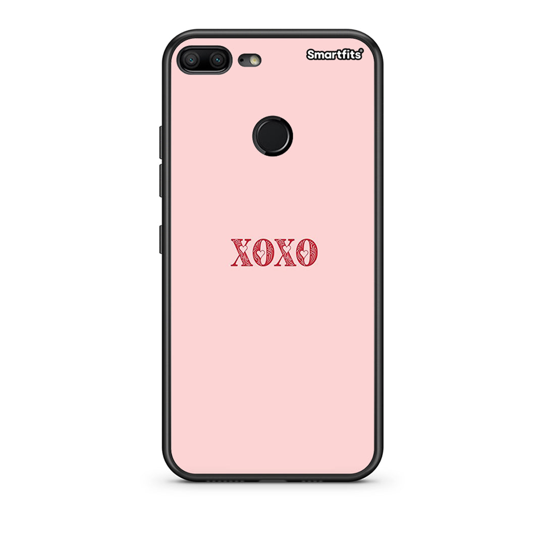 Xoxo Love - Honor 9 Lite case