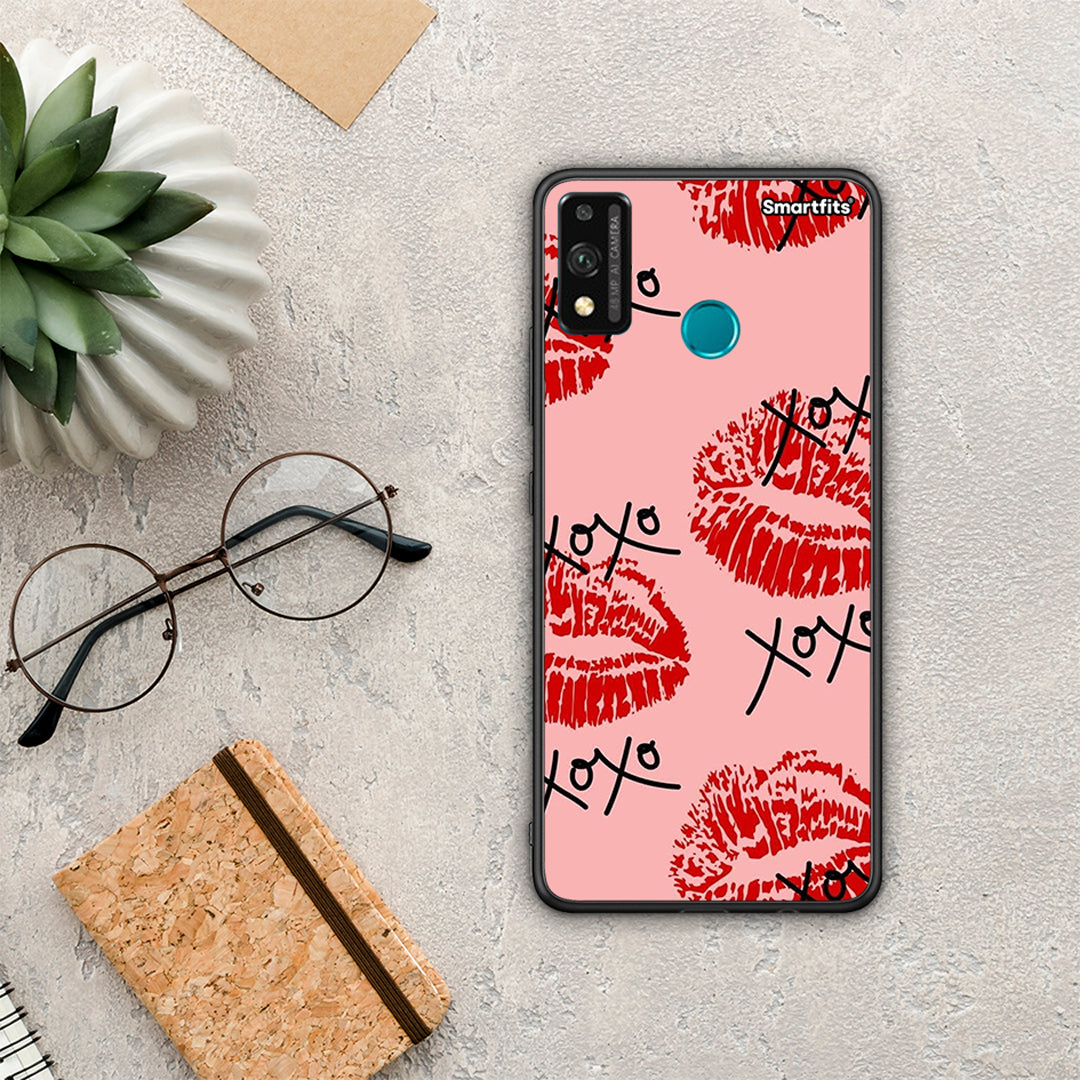 Xoxo Lips - Honor 9x Lite case