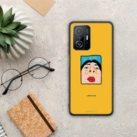 Thumbnail for So Cool - Xiaomi 11T / 11T Pro case