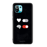 Thumbnail for Xiaomi Mi 11 Heart Vs Brain Θήκη Αγίου Βαλεντίνου από τη Smartfits με σχέδιο στο πίσω μέρος και μαύρο περίβλημα | Smartphone case with colorful back and black bezels by Smartfits