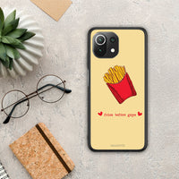 Thumbnail for Fries Before Guys - Xiaomi 11 Lite 5G NE / Mi 11 Lite case