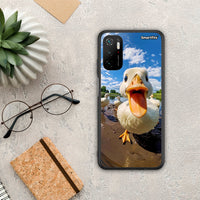 Thumbnail for Duck Face - Xiaomi Redmi Note 10 5G case