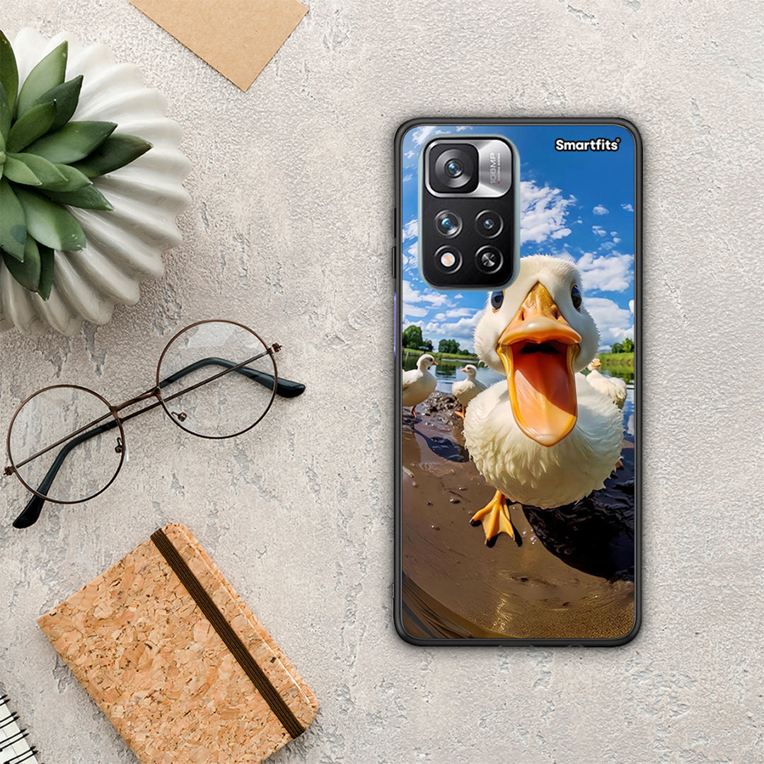 Duck Face - Xiaomi Redmi Note 11 Pro+ 5G case