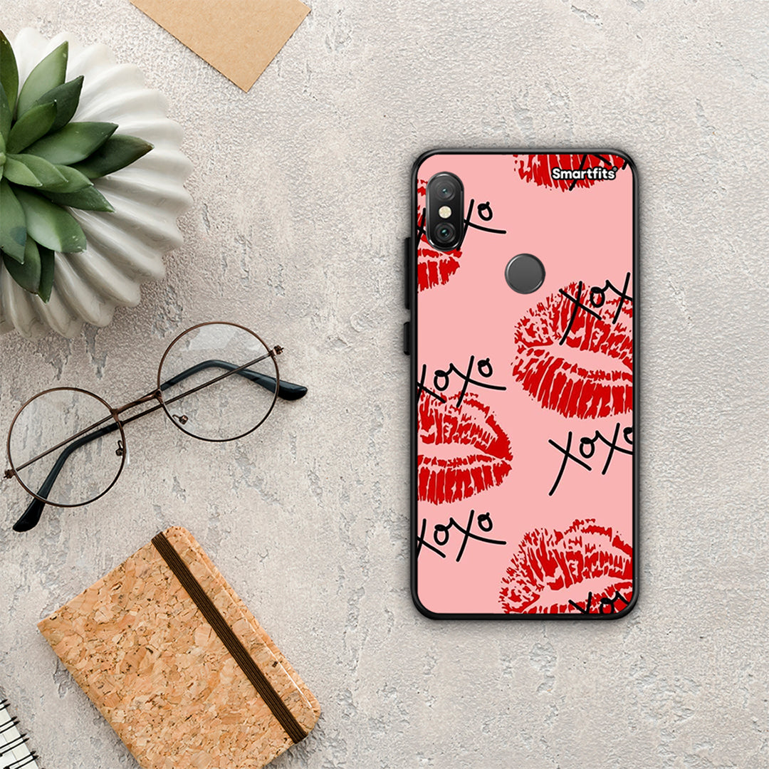 Xoxo Lips - Xiaomi Redmi Note 5 case